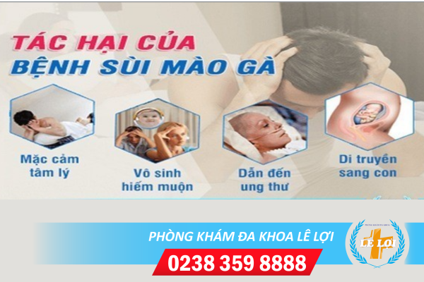 Địa chỉ khám bệnh sùi mào gà tại TP Vinh