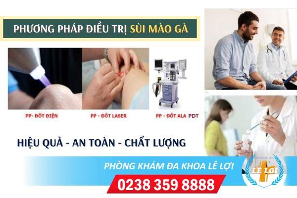 Chữa bệnh sùi mào gà hiệu quả bằng phương pháp nào?