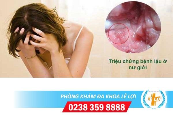 Cách khám bệnh lậu ở nữ hiệu quả