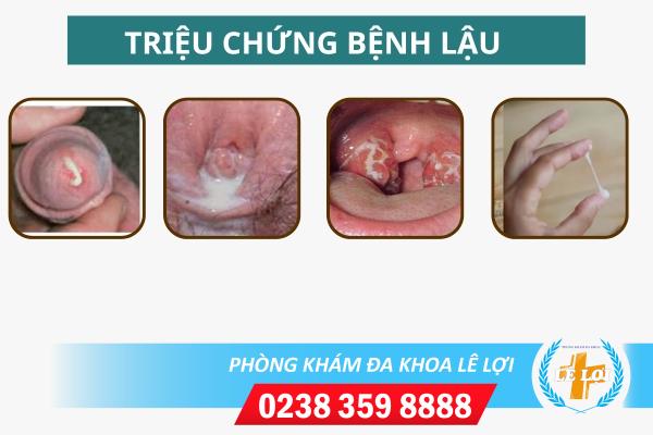 Chữa bệnh lậu hết bao nhiêu tiền?