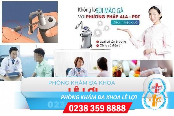 Chữa sùi mào gà an toàn, hiệu quả bằng phương pháp nào?