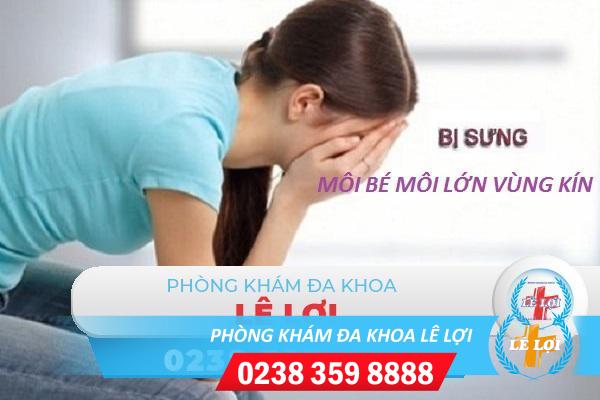 Sưng môi bé môi lớn vùng kín là bệnh gì?