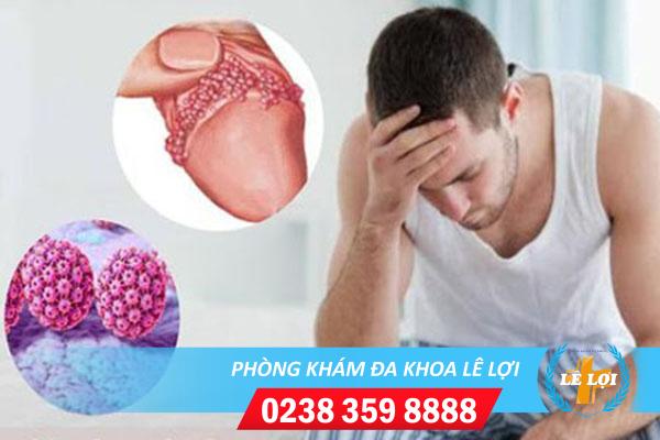 Điều trị sùi mào gà dương vật như thế nào?