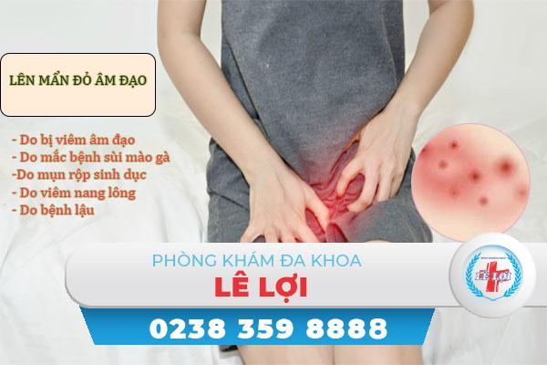 Nổi mẩn đỏ âm đạo nguy hiểm không bị bệnh gì?