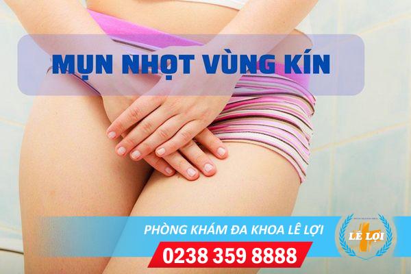 Tại sao nổi mụn nhọt vùng kín và cách điều trị