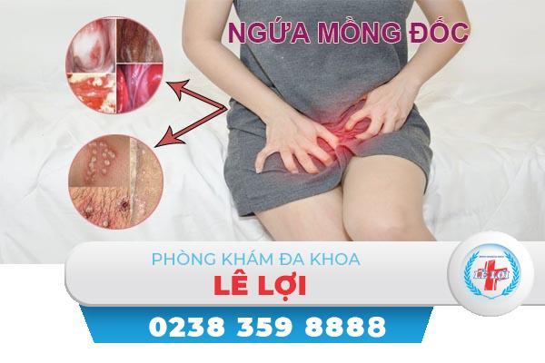 Cách điều trị ngứa mồng đốc hiệu quả