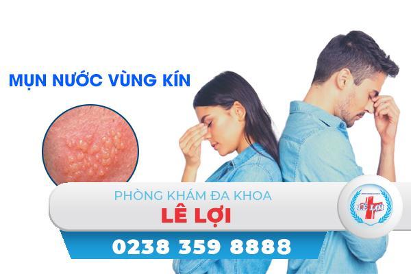 Những thông tin cần biết về mụn nước ở vùng kín