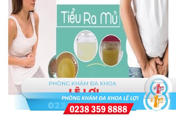 Nguyên nhân tiểu ra mủ và cách điều trị