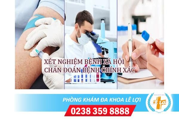 Cách xét nghiệm bệnh xã hội cho kết quả chính xác