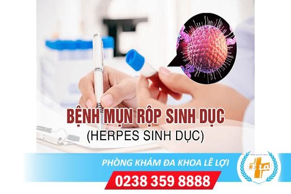 Cách xét nghiệm mụn rộp sinh dục và chi phí