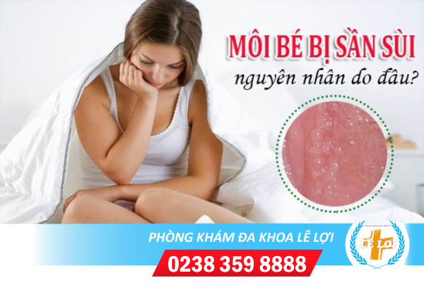 Giải pháp điều trị nốt sần ở môi bé môi lớn