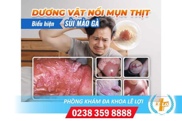 Nội dung đoạn văn bản của bạn - 2024-04-23T083605.839