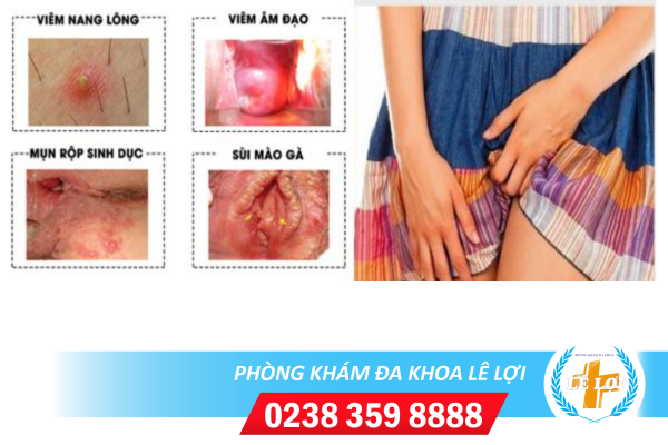 Bị nổi mụn mủ hột le phải làm sao?