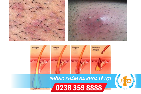 Nội dung đoạn văn bản của bạn (32)