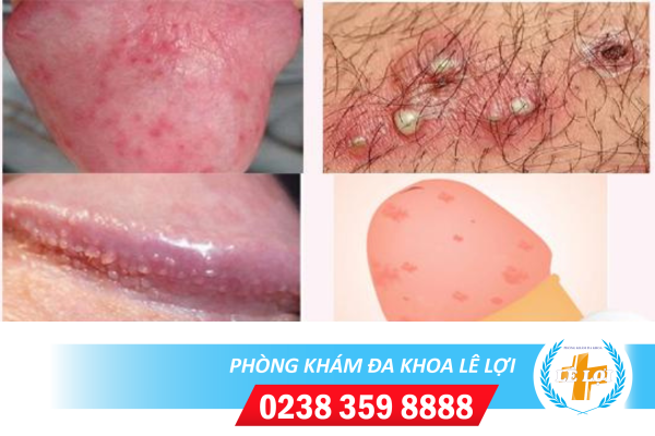 Nội dung đoạn văn bản của bạn (33)