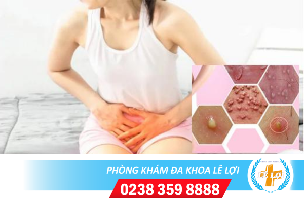 Khám, điều trị nổi mụn mủ âm đạo ở đâu?