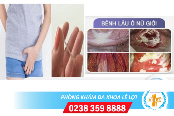 Nội dung đoạn văn bản của bạn (41)