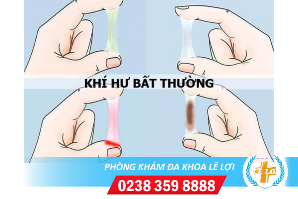 Cảnh báo nguy hiểm khi âm đạo ra dịch bất thường