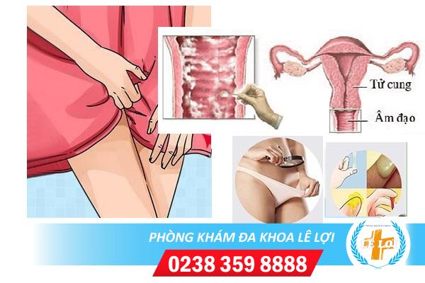 Âm đạo chảy mủ là bệnh gì và cách khắc phục