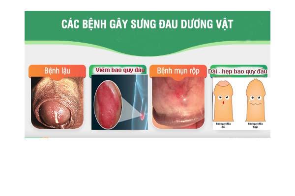 dau-sung-duong-vat