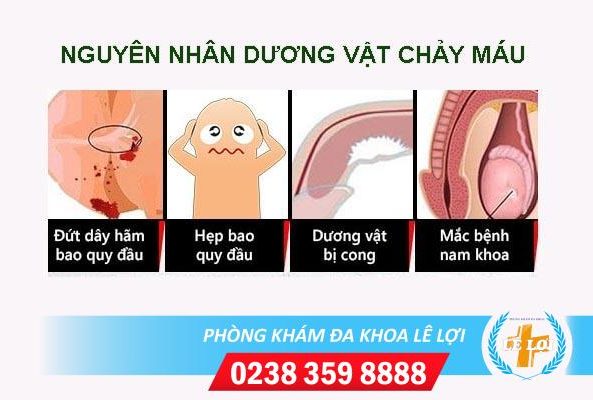 Nguyên nhân dương vật chảy máu và cách chữa trị