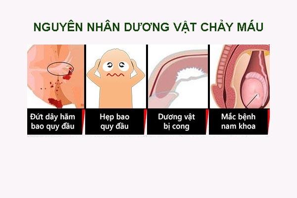 duong-vat-chay-mau-nguyen-nhan