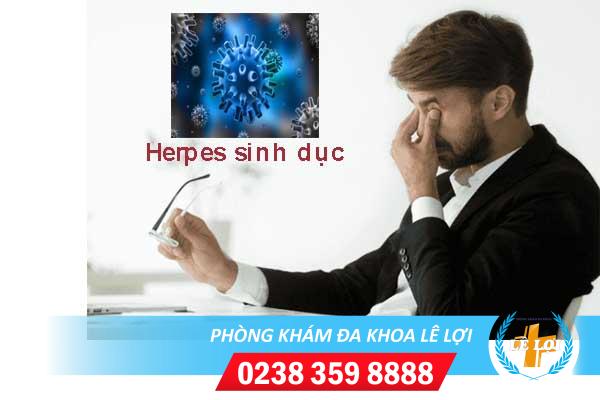 Triệu chứng bệnh herpes sinh dục và cách điều trị