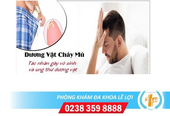 Lỗ sáo chảy mủ cẩn thận với bệnh lậu