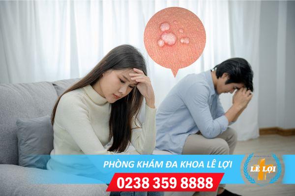 Phương pháp chữa mụn cơm vùng kín hiệu quả