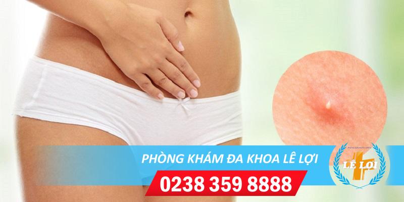 Làm thế nào khi gặp hiện tượng nốt sần ở vùng kín?