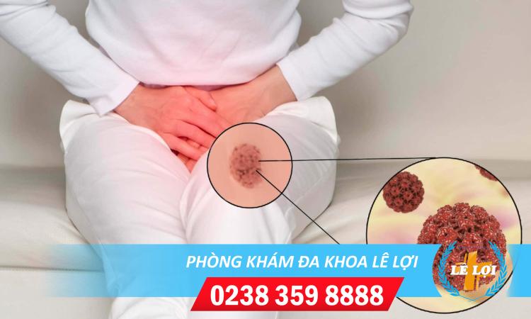 Phương pháp điều trị u nhú âm đạo