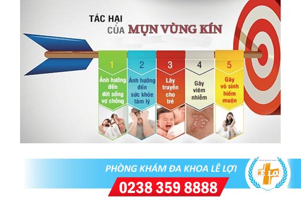 Phương pháp chữa mụn vùng kín hiệu quả hiện nay