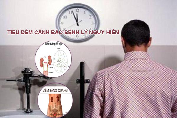 Tiểu đêm nhiều là bị bệnh gì?