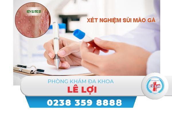 Xét nghiệm bệnh hpv là gì? địa chỉ uy tín