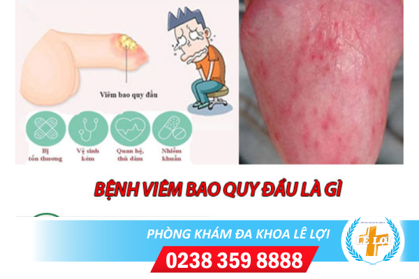 Nội dung đoạn văn bản của bạn (81)