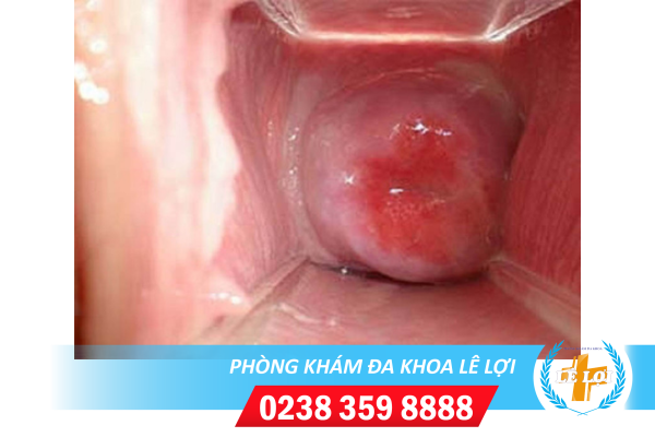 Nội dung đoạn văn bản của bạn (84)