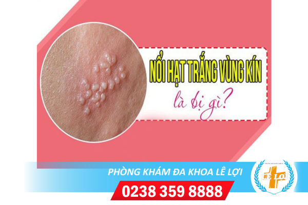 Cảnh giác nguy hiểm khi nổi mụn trắng li ti vùng kín