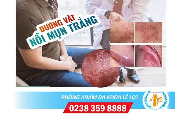 Mụn trắng quy đầu là bị gì?