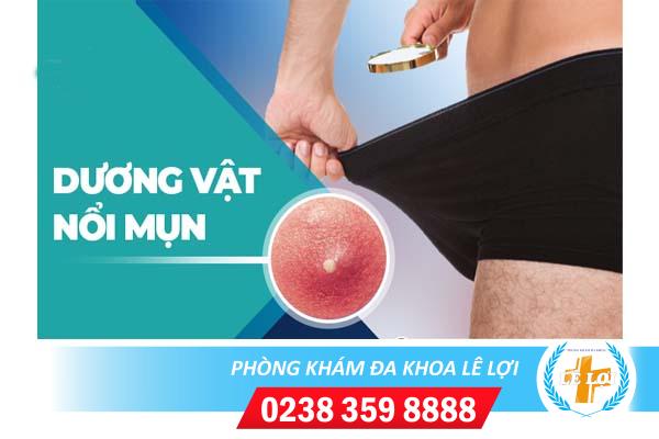 Nổi mụn dương vật là dấu hiệu bệnh gì?