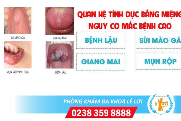 Nguy cơ mắc bệnh xã hội khi quan hệ qua đường miệng