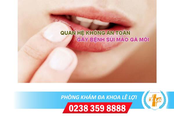 Bệnh sùi mào gà môi nguyên nhân và cách điều trị