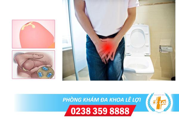 Viêm đường tiết niệu có mủ nguy hiểm không?