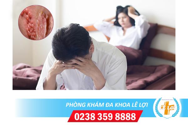 Sùi mào gà chữa được không?