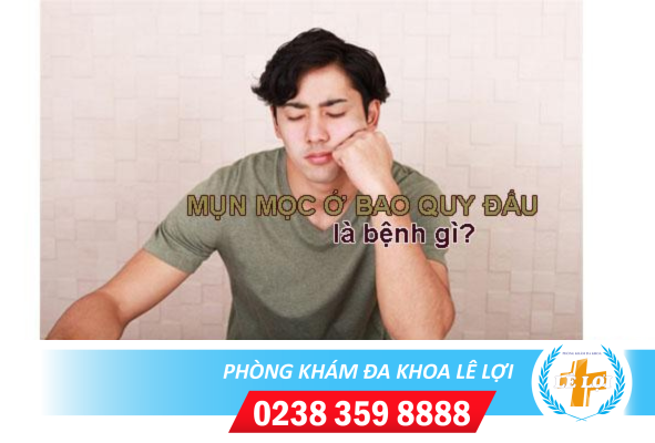 Mụn mọc ở bao quy đầu là bị bệnh gì?