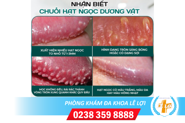 Nội dung đoạn văn bản của bạn (82)