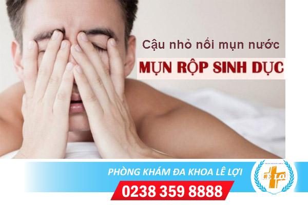 Cậu nhỏ bị nổi mụn nước: nguyên nhân, cách điều trị