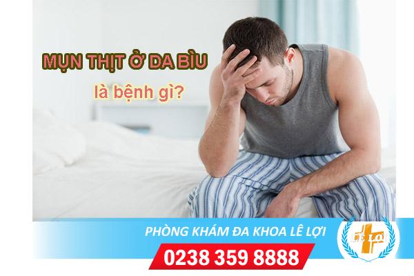 Mụn thịt ở da bìu nguyên nhân và cách chữa hiệu quả