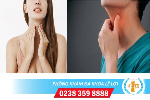 Triệu chứng bệnh lậu ở họng và cách điều trị