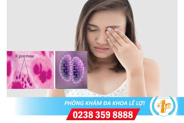 Bệnh lậu ở mắt dấu hiệu nhận biết và cách điều trị