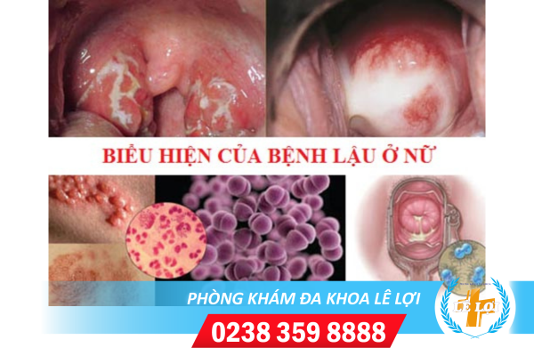 Nội dung đoạn văn bản của bạn (59)